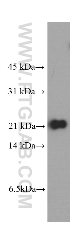 Western Blot (WB) analysis of HEK-293 cells using peroxiredoxin 2 Monoclonal antibody (60202-1-Ig)