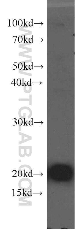 peroxiredoxin 2