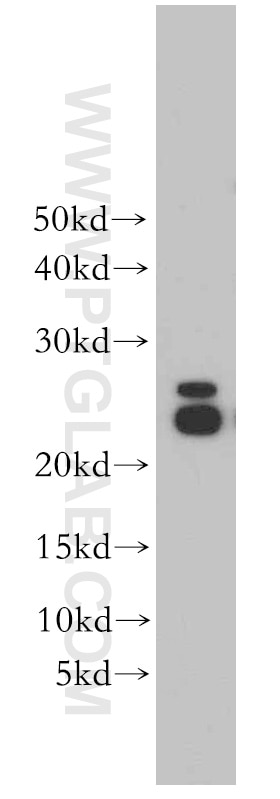 Western Blot (WB) analysis of mouse liver tissue using PRDX3 Polyclonal antibody (55087-1-AP)