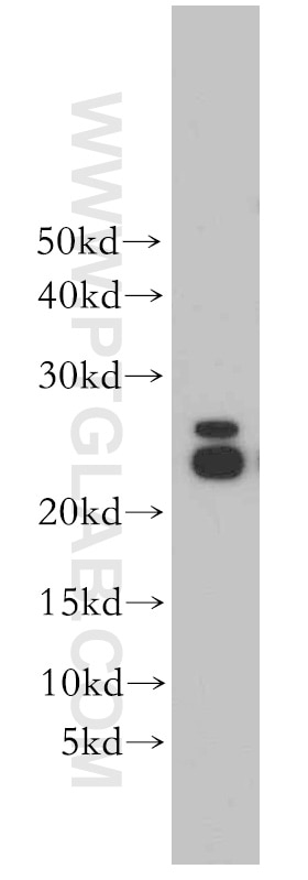 WB analysis of mouse liver using 55087-1-AP