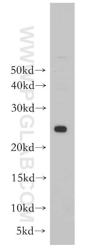Western Blot (WB) analysis of mouse liver tissue using PRDX3 Polyclonal antibody (55087-1-AP)