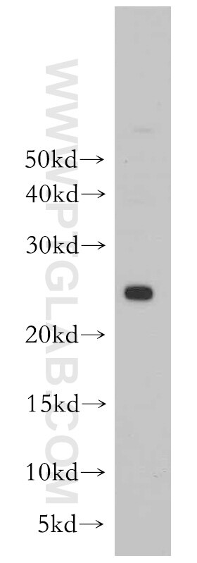 WB analysis of mouse liver using 55087-1-AP