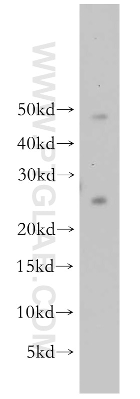 Western Blot (WB) analysis of mouse brain tissue using PRDX3 Polyclonal antibody (55087-1-AP)