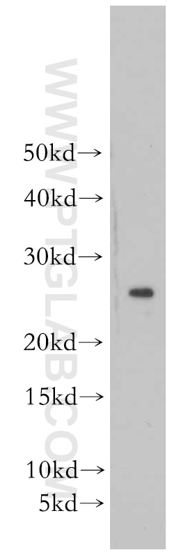 Western Blot (WB) analysis of mouse brain tissue using PRDX3 Polyclonal antibody (55087-1-AP)
