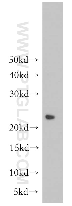 Western Blot (WB) analysis of mouse brain tissue using PRDX3 Polyclonal antibody (55087-1-AP)