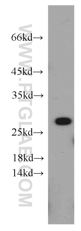 Western Blot (WB) analysis of HEK-293 cells using PRDX3 Polyclonal antibody (55087-1-AP)