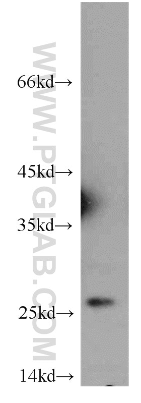 Western Blot (WB) analysis of Jurkat cells using PRDX3 Polyclonal antibody (55087-1-AP)