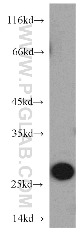 Western Blot (WB) analysis of MCF-7 cells using PRDX3 Polyclonal antibody (55087-1-AP)