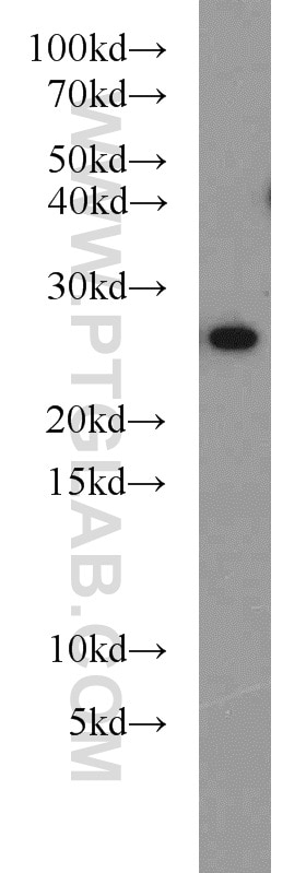 Western Blot (WB) analysis of MCF-7 cells using PRDX3 Polyclonal antibody (55087-1-AP)