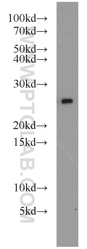 Western Blot (WB) analysis of HeLa cells using PRDX3 Polyclonal antibody (55087-1-AP)