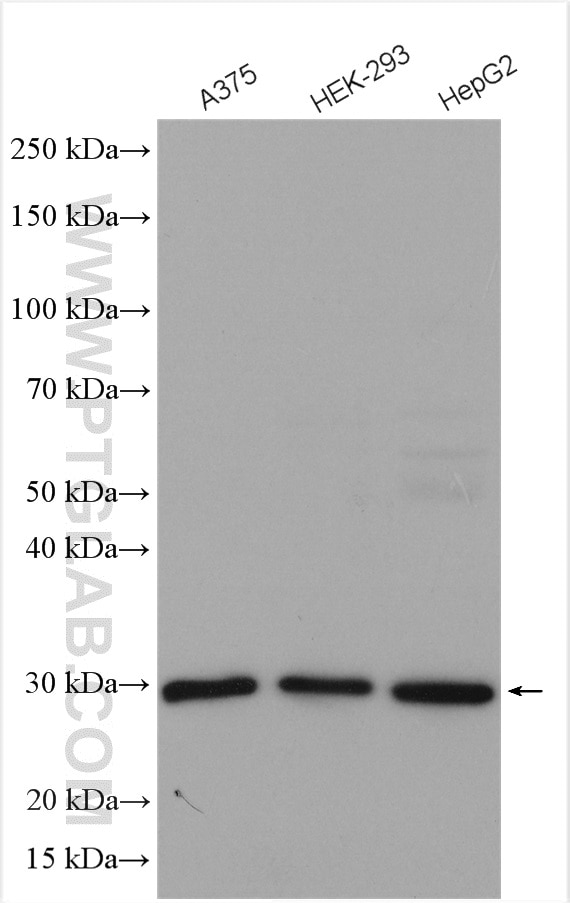 Western Blot (WB) analysis of various lysates using PRDX4 Polyclonal antibody (10703-1-AP)