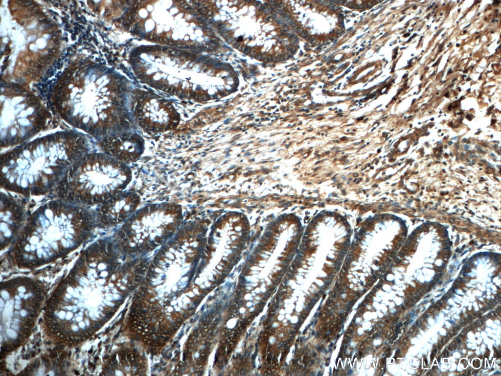 Immunohistochemistry (IHC) staining of human colon tissue using PRDX4 Monoclonal antibody (60286-1-Ig)
