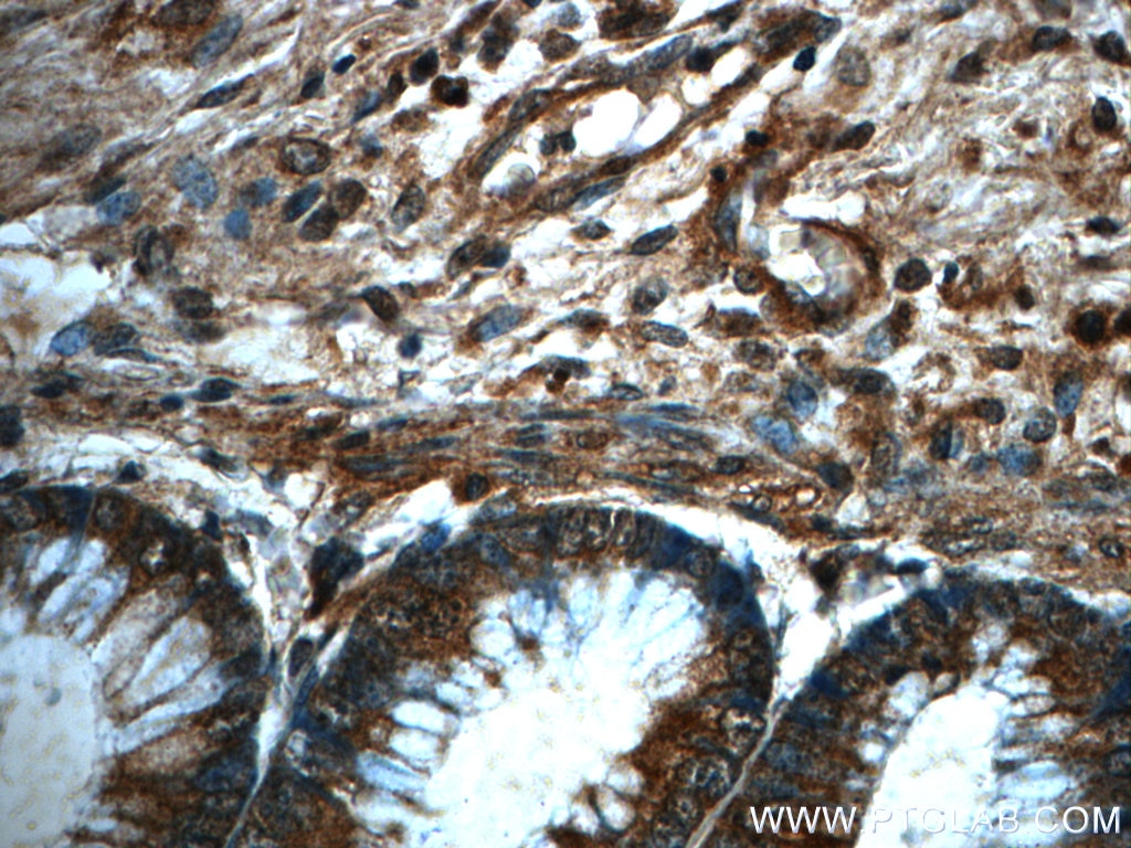 Immunohistochemistry (IHC) staining of human colon tissue using PRDX4 Monoclonal antibody (60286-1-Ig)