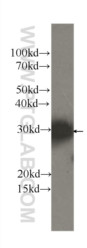 WB analysis of HeLa using 60286-1-Ig