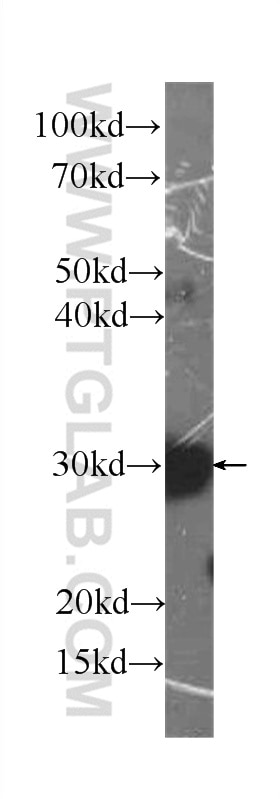Western Blot (WB) analysis of HepG2 cells using PRDX4 Monoclonal antibody (60286-1-Ig)