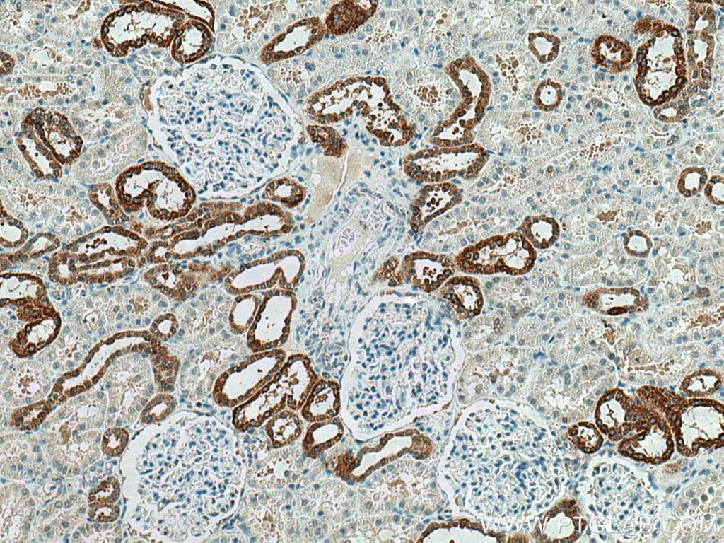 Immunohistochemistry (IHC) staining of human kidney tissue using PRX5 Polyclonal antibody (17724-1-AP)