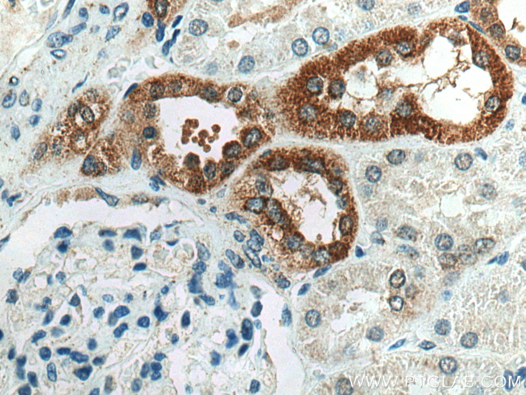 Immunohistochemistry (IHC) staining of human kidney tissue using PRX5 Polyclonal antibody (17724-1-AP)