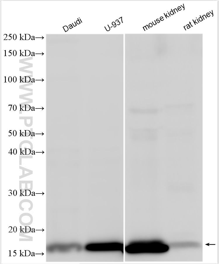 Western Blot (WB) analysis of various lysates using PRX5 Polyclonal antibody (17724-1-AP)