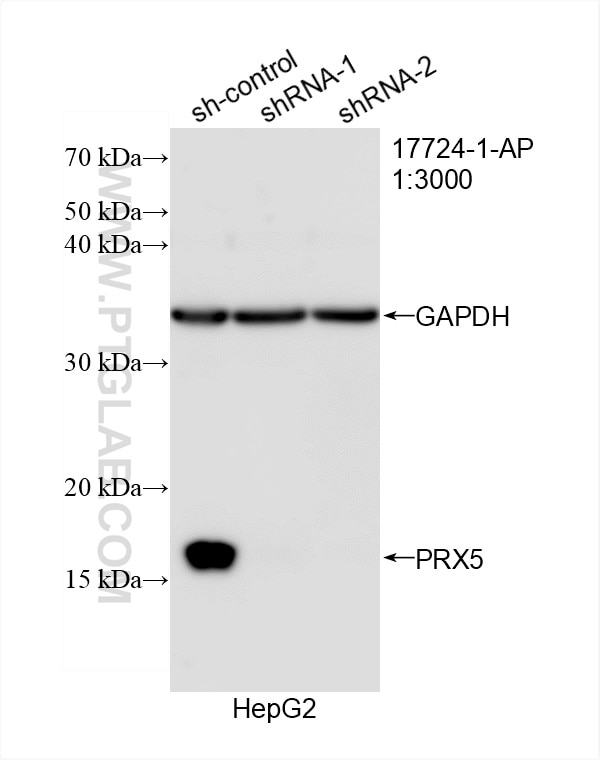 Western Blot (WB) analysis of HepG2 cells using PRX5 Polyclonal antibody (17724-1-AP)