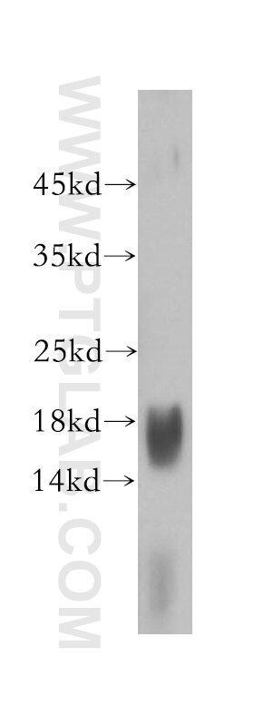 Western Blot (WB) analysis of human liver tissue using PRX5 Polyclonal antibody (17724-1-AP)