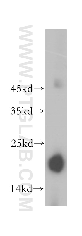 Western Blot (WB) analysis of mouse kidney tissue using PRX5 Polyclonal antibody (17724-1-AP)