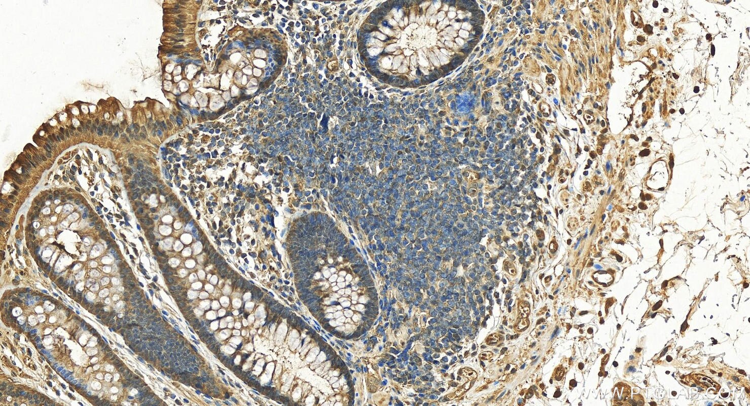 Immunohistochemistry (IHC) staining of human colon tissue using PRDX6 Polyclonal antibody (13585-1-AP)