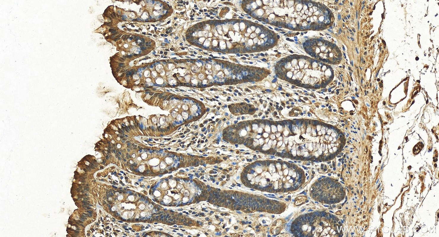 Immunohistochemistry (IHC) staining of human colon tissue using PRDX6 Polyclonal antibody (13585-1-AP)