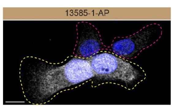 Immunofluorescence (IF) / fluorescent staining of HAP1 using PRDX6 Polyclonal antibody (13585-1-AP)