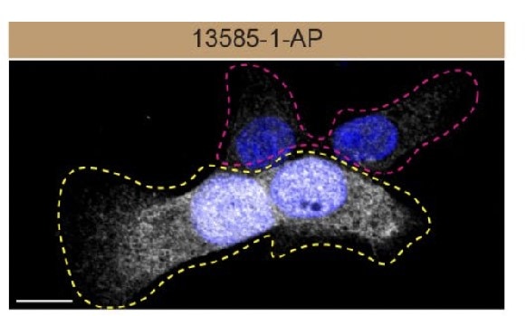 Immunofluorescence (IF) / fluorescent staining of HAP1 cells using PRDX6 Polyclonal antibody (13585-1-AP)