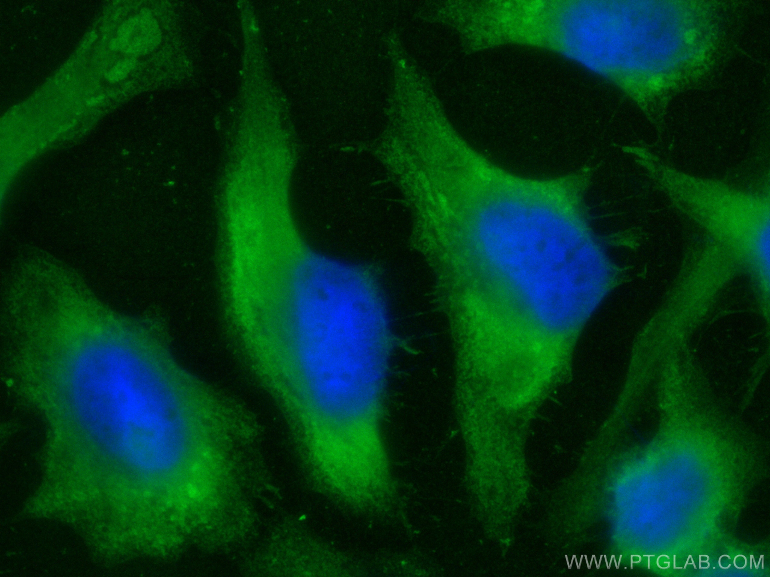Immunofluorescence (IF) / fluorescent staining of HeLa cells using PRDX6 Polyclonal antibody (13585-1-AP)