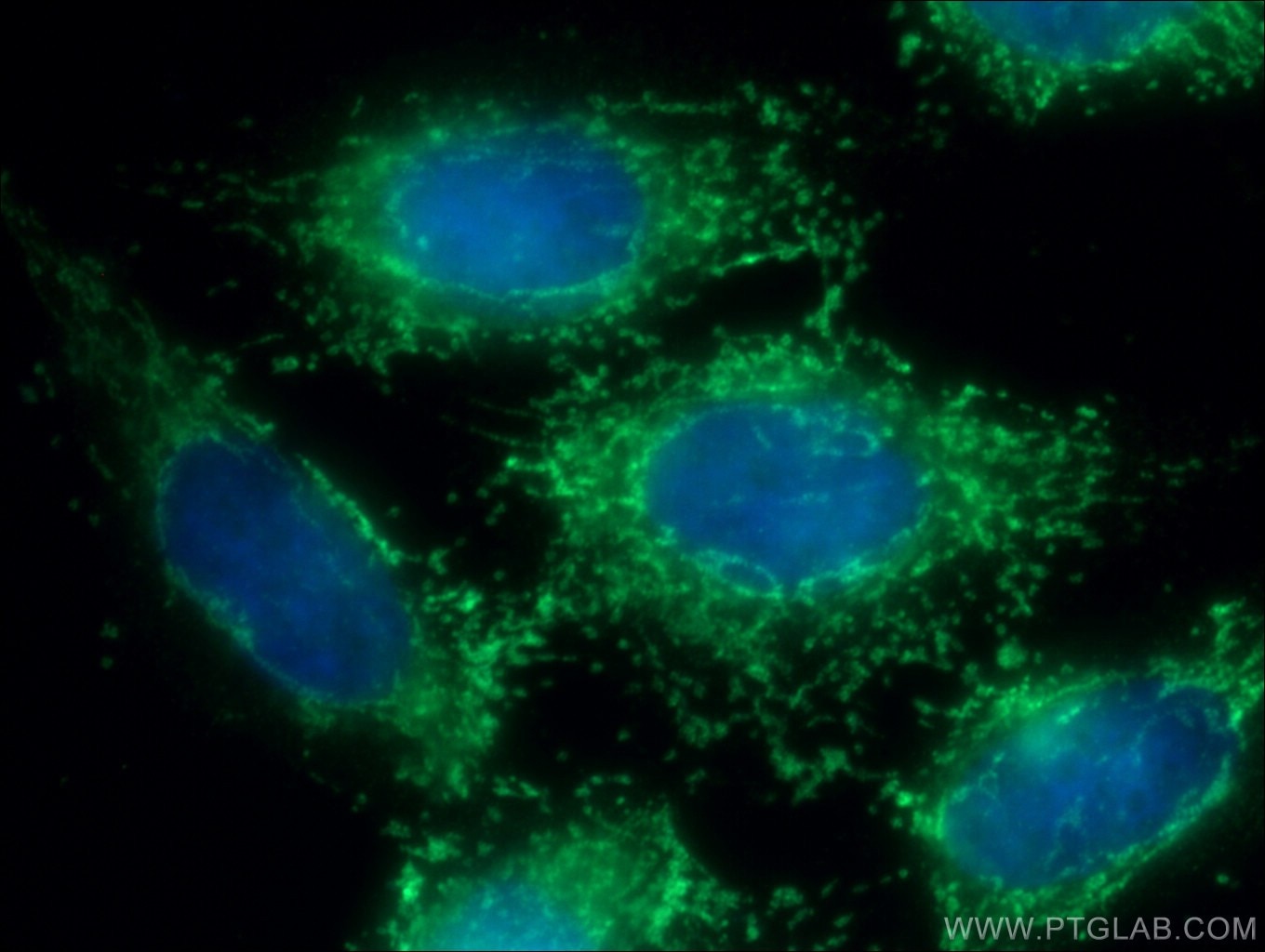 Immunofluorescence (IF) / fluorescent staining of HeLa cells using PRDX6 Polyclonal antibody (13585-1-AP)
