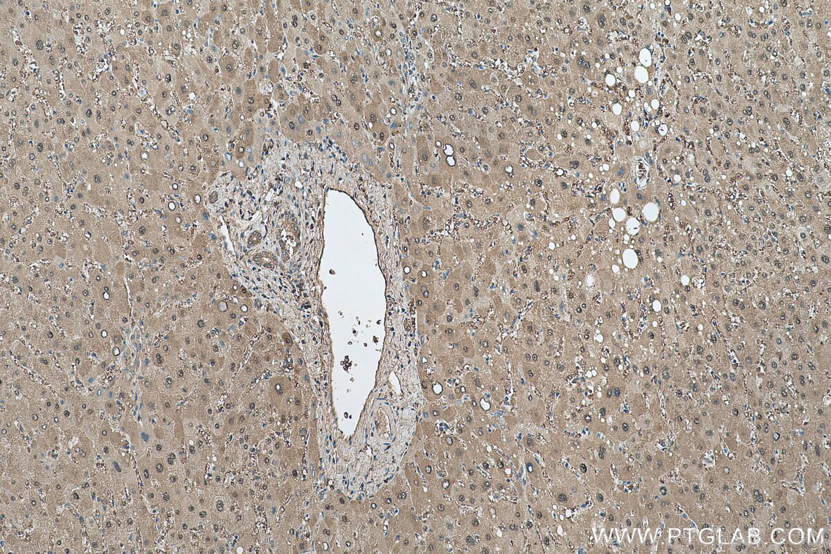 Immunohistochemistry (IHC) staining of human liver tissue using PRDX6 Polyclonal antibody (13585-1-AP)