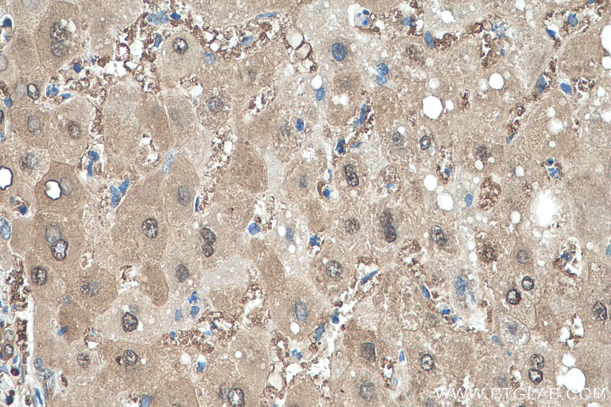 Immunohistochemistry (IHC) staining of human liver tissue using PRDX6 Polyclonal antibody (13585-1-AP)