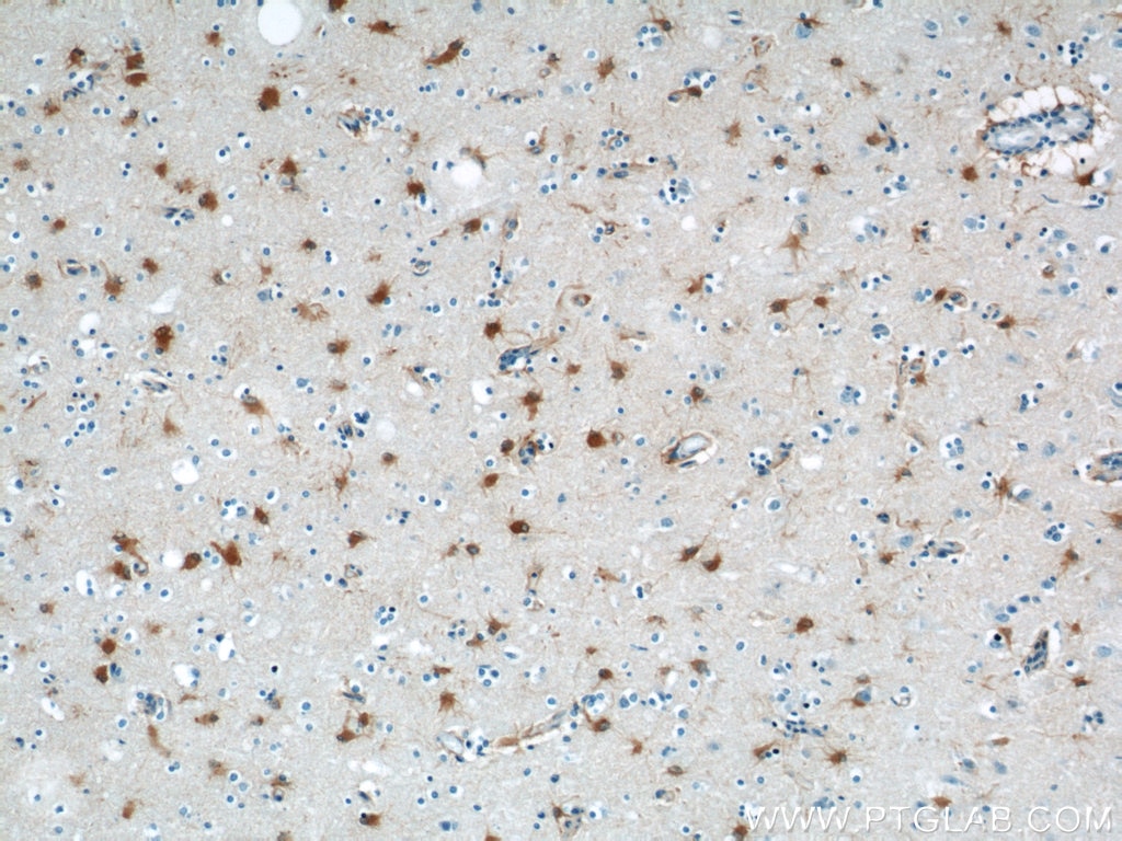 Immunohistochemistry (IHC) staining of human brain tissue using PRDX6 Polyclonal antibody (13585-1-AP)