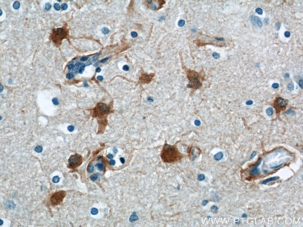Immunohistochemistry (IHC) staining of human brain tissue using PRDX6 Polyclonal antibody (13585-1-AP)