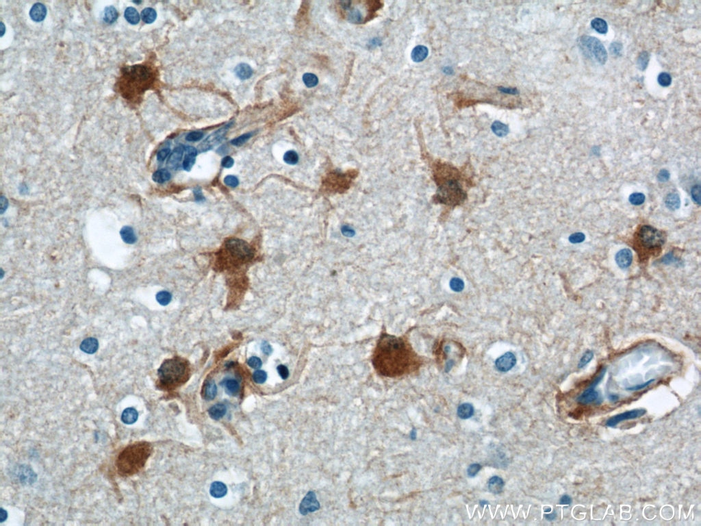 IHC staining of human brain using 13585-1-AP