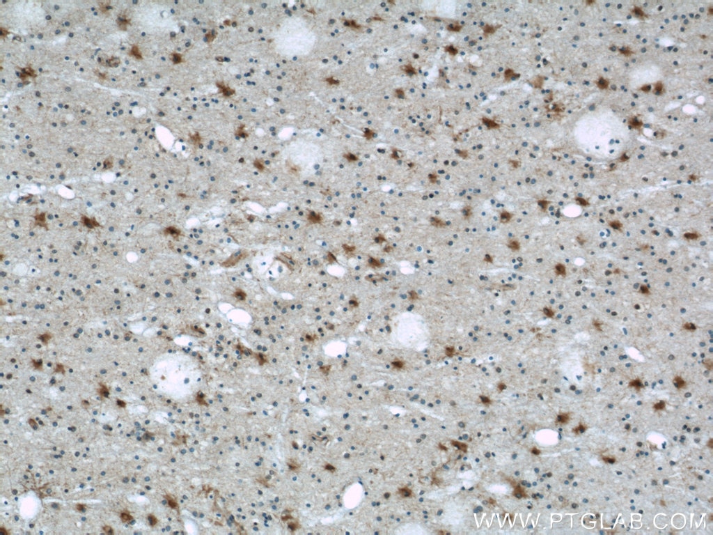 Immunohistochemistry (IHC) staining of human brain tissue using PRDX6 Polyclonal antibody (13585-1-AP)