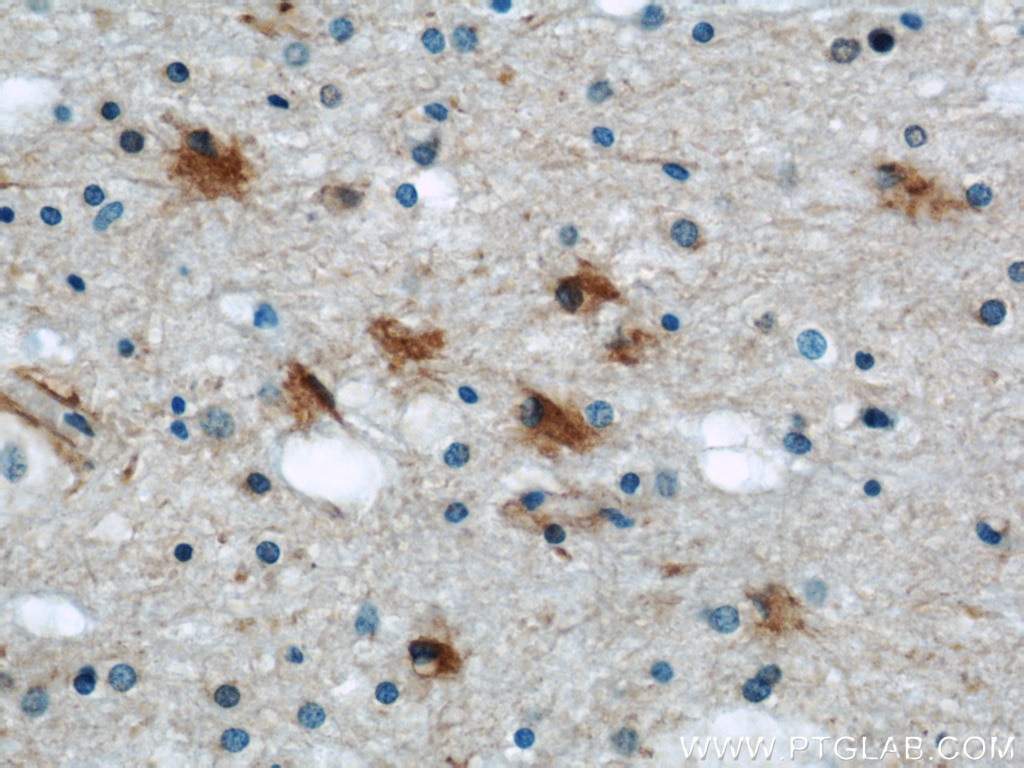 IHC staining of human brain using 13585-1-AP