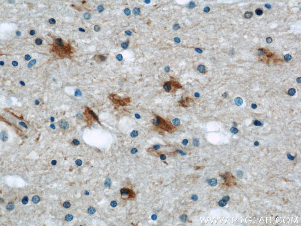 Immunohistochemistry (IHC) staining of human brain tissue using PRDX6 Polyclonal antibody (13585-1-AP)