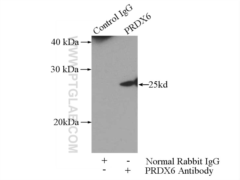 Immunoprecipitation (IP) experiment of HeLa cells using PRDX6 Polyclonal antibody (13585-1-AP)