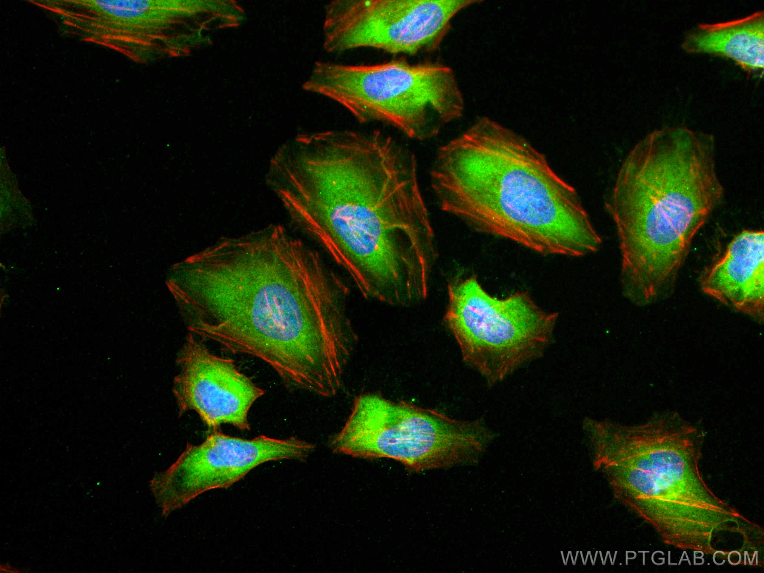 Immunofluorescence (IF) / fluorescent staining of HeLa cells using PRDX6 Monoclonal antibody (67499-1-Ig)