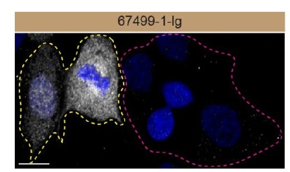 Immunofluorescence (IF) / fluorescent staining of HAP1 using PRDX6 Monoclonal antibody (67499-1-Ig)