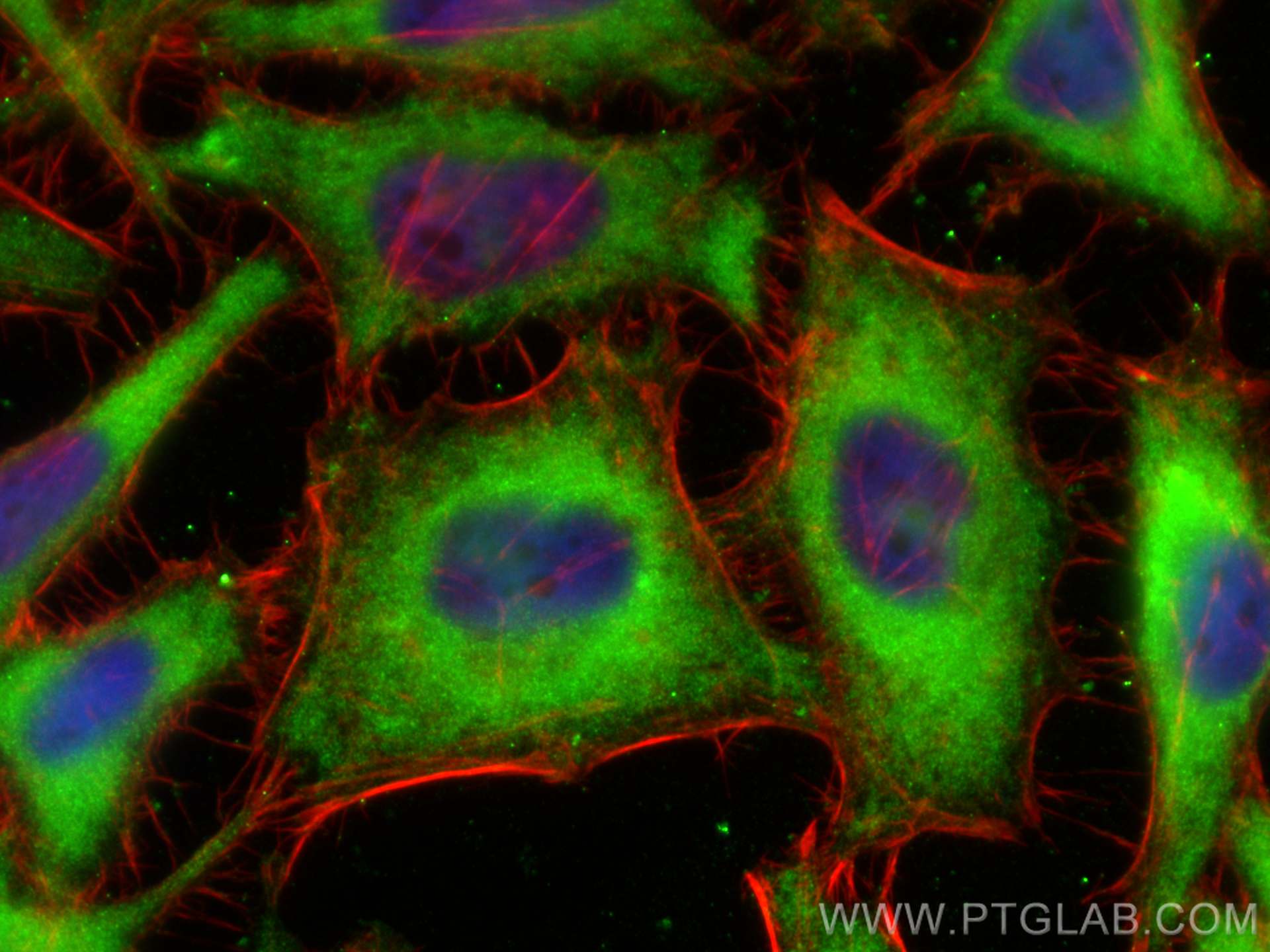 Immunofluorescence (IF) / fluorescent staining of HeLa cells using PRDX6 Monoclonal antibody (67499-1-Ig)