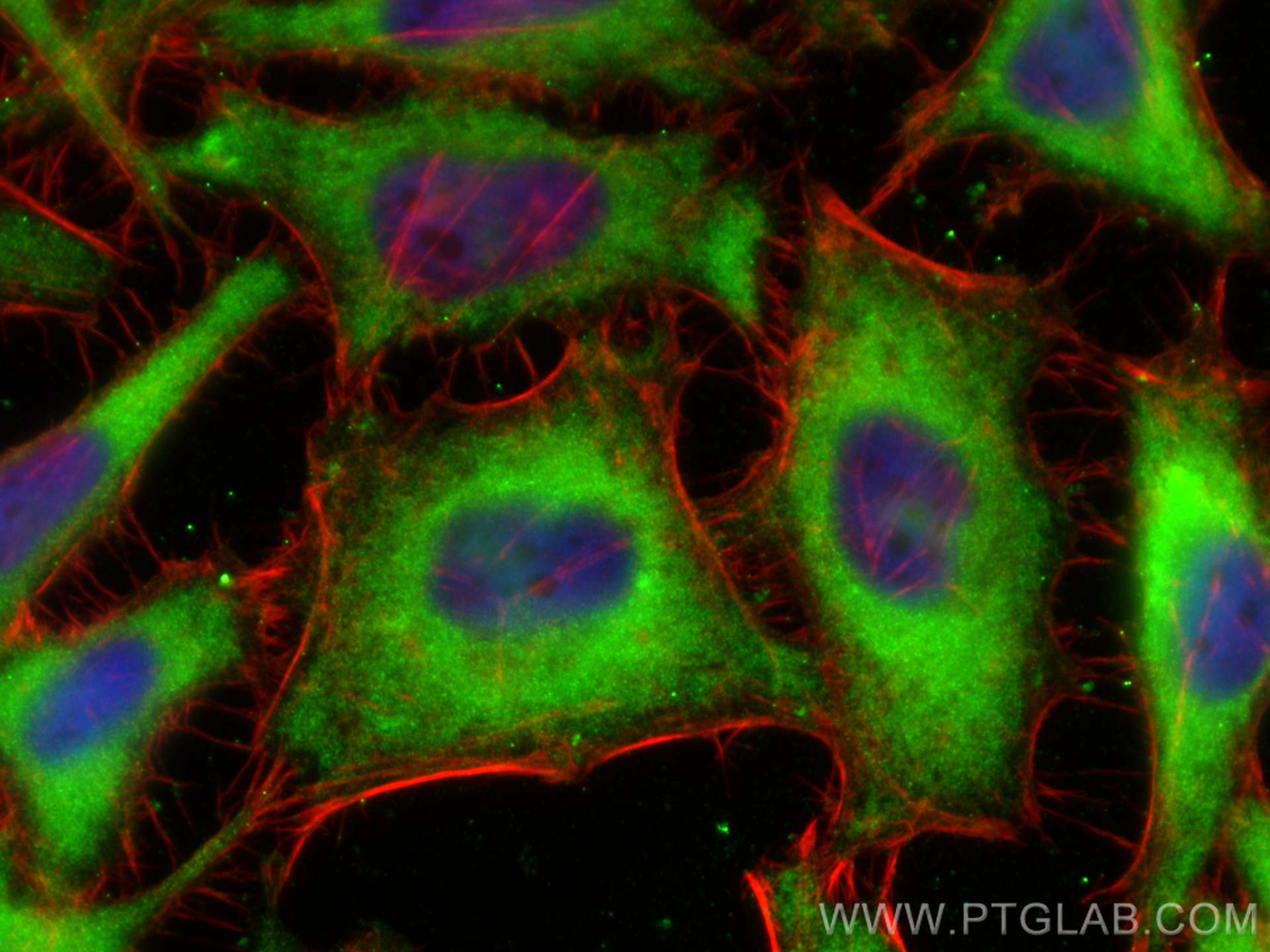 IF Staining of HeLa using 67499-1-Ig