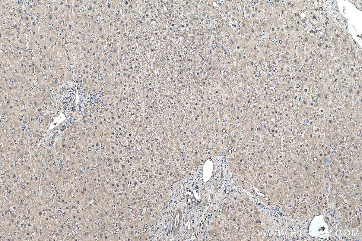 Immunohistochemistry (IHC) staining of human liver tissue using PRDX6 Monoclonal antibody (67499-1-Ig)