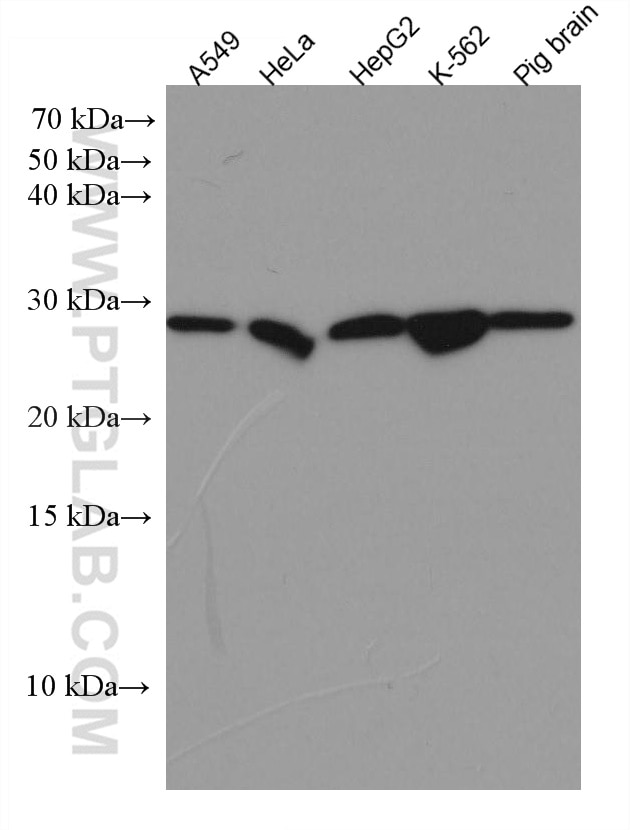 WB analysis using 67499-1-Ig