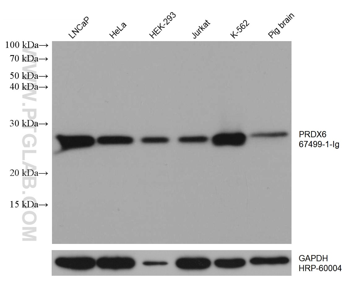 Western Blot (WB) analysis of various lysates using PRDX6 Monoclonal antibody (67499-1-Ig)