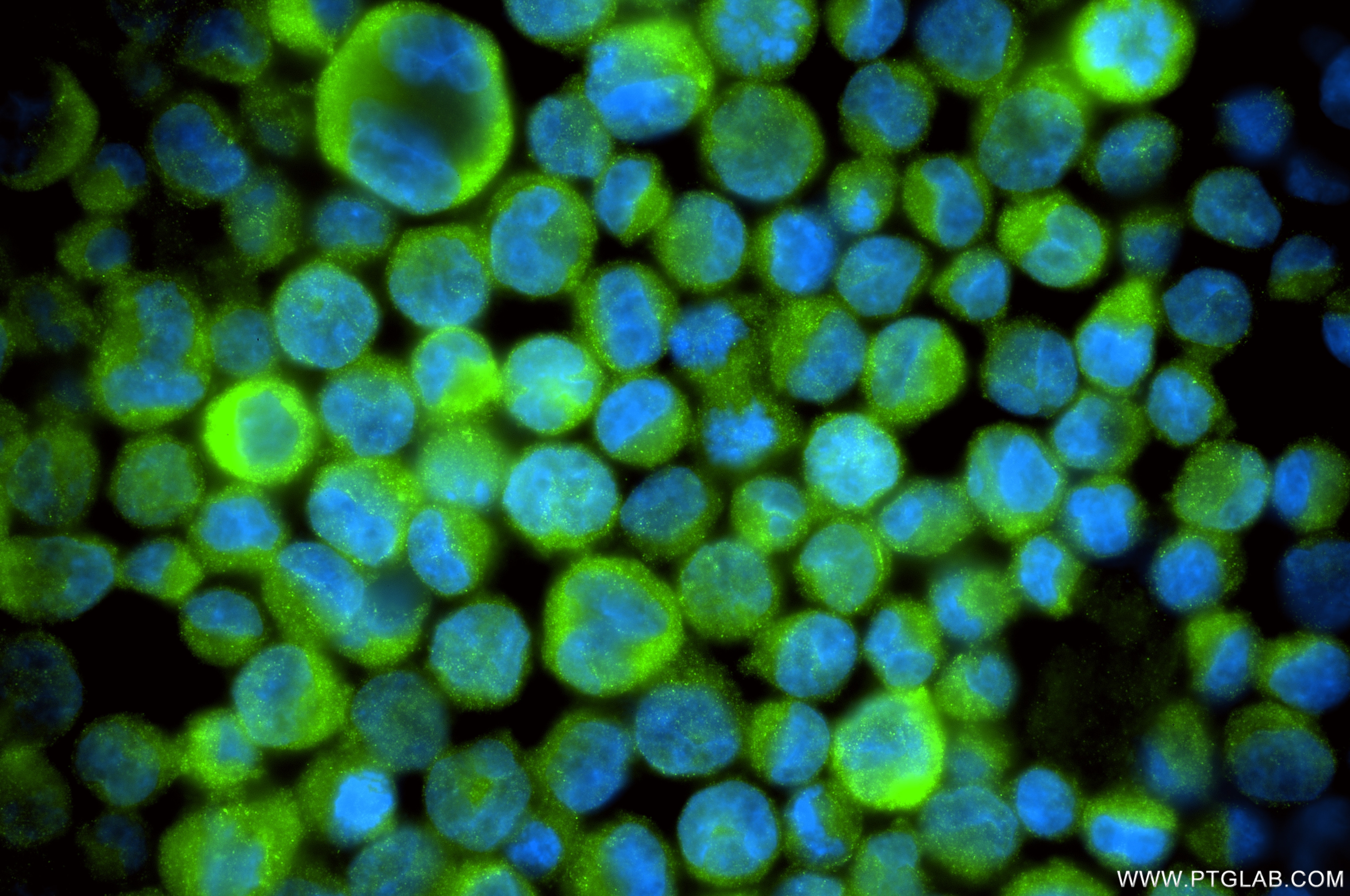 Immunofluorescence (IF) / fluorescent staining of K-562 cells using PRDX6 Recombinant monoclonal antibody (86368-1-RR)