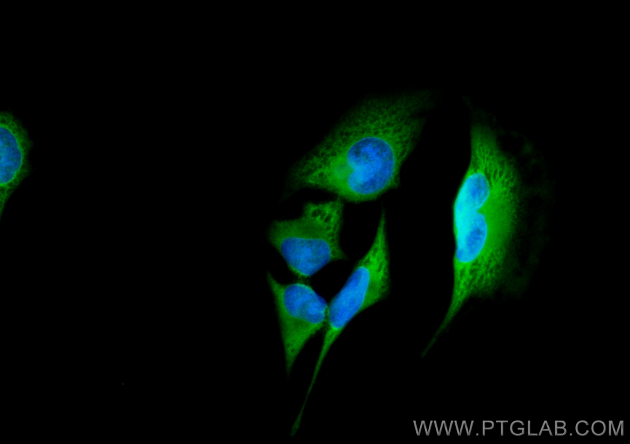 Immunofluorescence (IF) / fluorescent staining of HeLa cells using CoraLite® Plus 488-conjugated PRDX6 Polyclonal ant (CL488-13585)