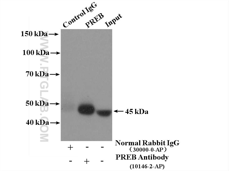 Immunoprecipitation (IP) experiment of SKOV-3 cells using PREB Polyclonal antibody (10146-2-AP)